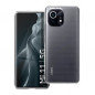 XIAOMI Mi 11 Hülle CLEAR 2mm Durchsichtbar